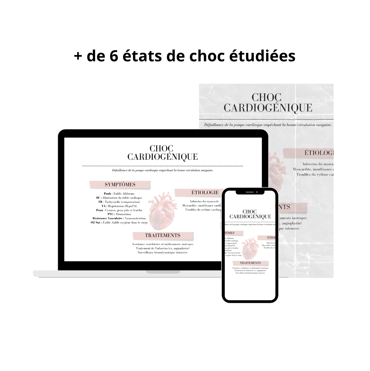 Les Chocs Hypovolémiques - 7 Fiches